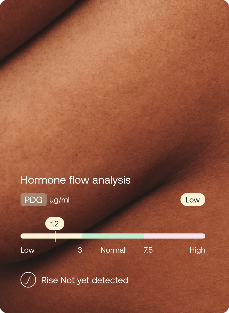Mira Ultra4 hormone flow analysis showing PDG level at 1.2 µg/ml, marked Low, with rise not yet detected