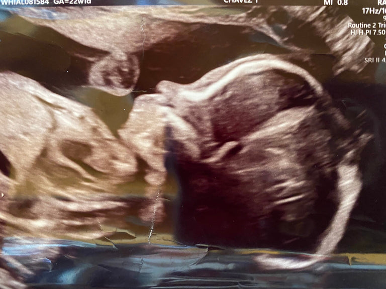 Cate A., 35 | Successful Insemination with Accurate Timing