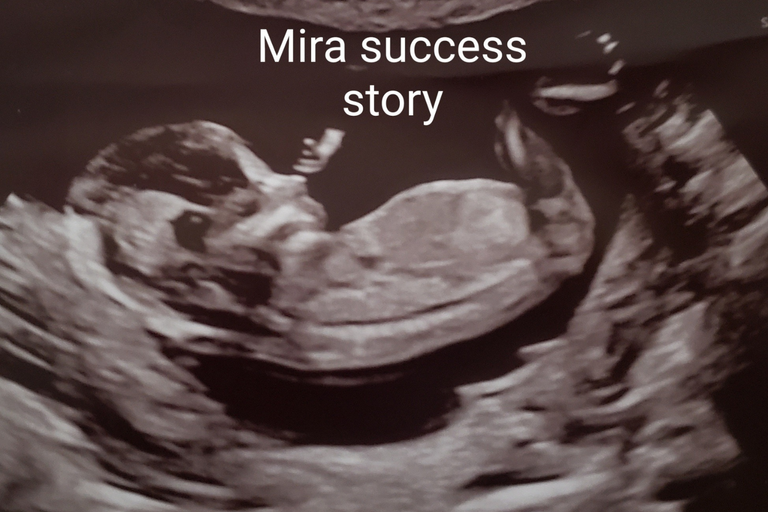 Domnique N., 38 | Conceiving After Miscarriages