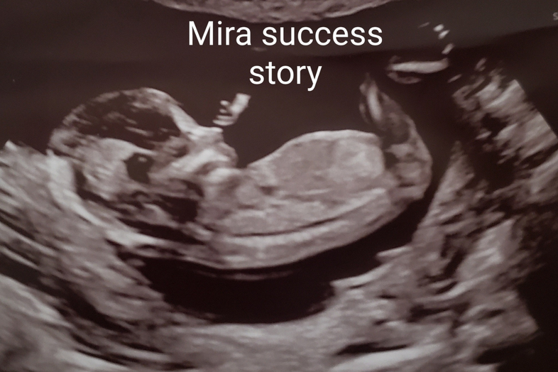 Domnique N., 38 | Conceiving After Miscarriages