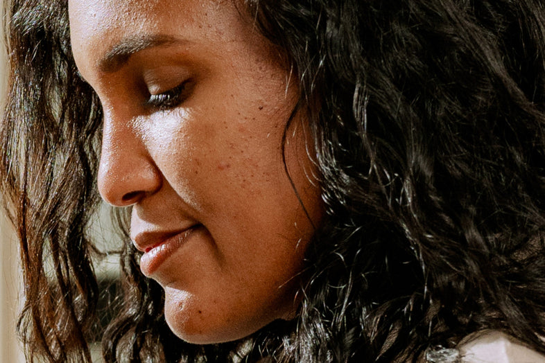 PCOS Acne: Effective Treatments &amp; Solutions