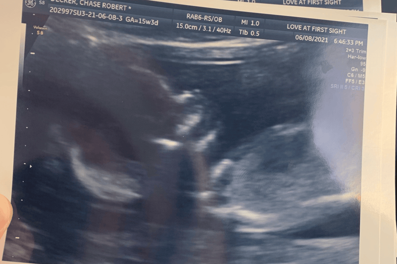 Jennifer, 31 | Conceiving After Multiple Miscarriages