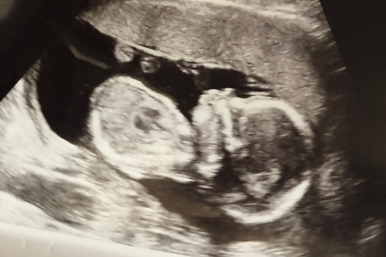 Kristin J., 27 | Conceiving After Miscarriage and Long Cycles