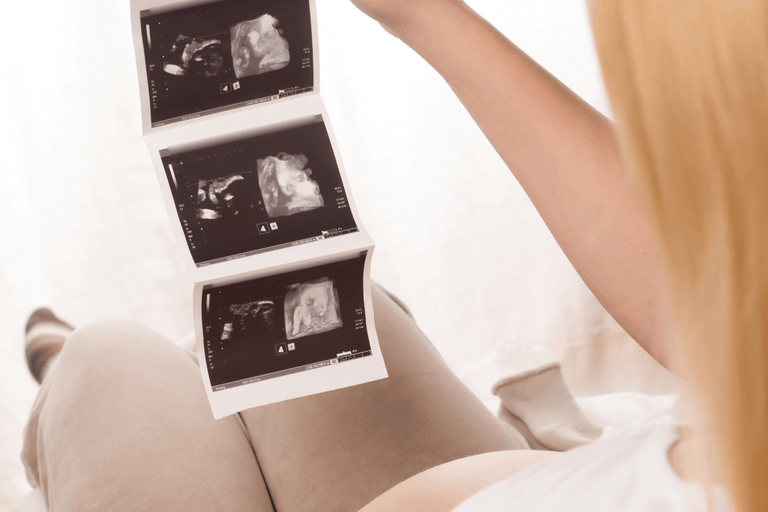 woman with ultrasound