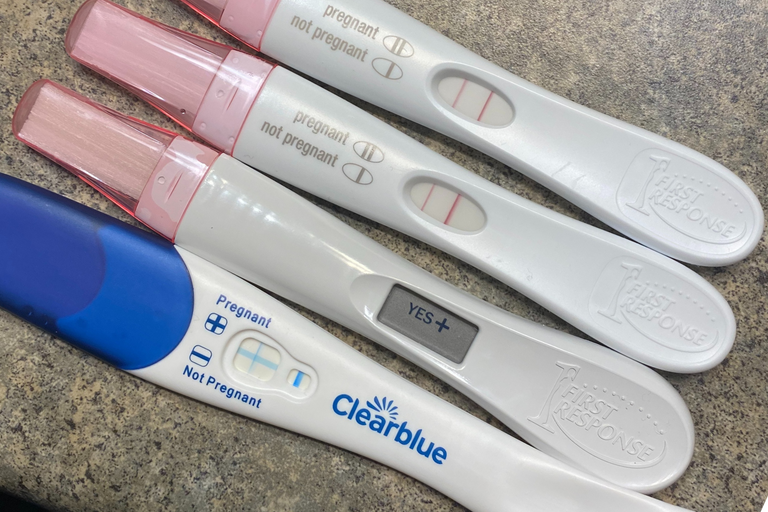 Patricia P. | Conceiving After PCOS Diagnosis and Fertility Treatments