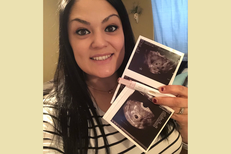 Kristie E. | Pregnant with a Rare Blood Clotting Disorder