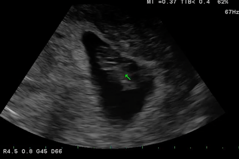 Octavia | Conceiving at 40 After Weight Loss and Healing