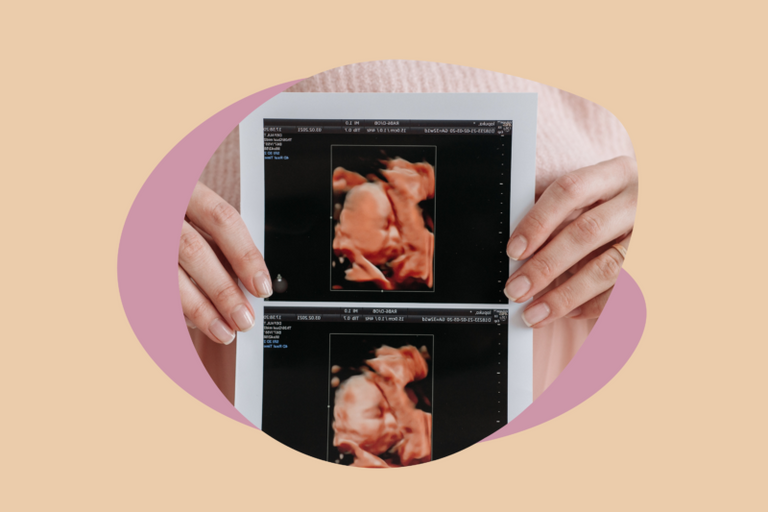 TTC Meaning Explained: Tips, Acronyms, and Guidance for Your Pregnancy Journey