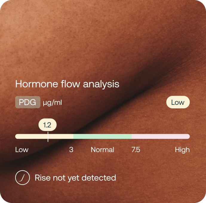 Mira Ultra4 hormone flow analysis showing PDG level at 1.2 µg/ml, marked Low, with rise not yet detected